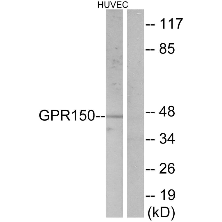 Western Blot - Anti-GPR150 Antibody (G136) - Antibodies.com