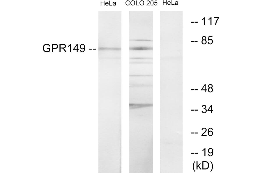 Western Blot - Anti-GPR149 Antibody (G300) - Antibodies.com
