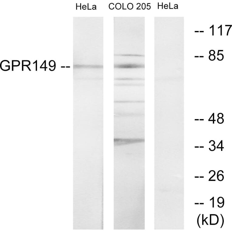 Western Blot - Anti-GPR149 Antibody (G300) - Antibodies.com