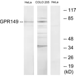 Western Blot - Anti-GPR149 Antibody (G300) - Antibodies.com