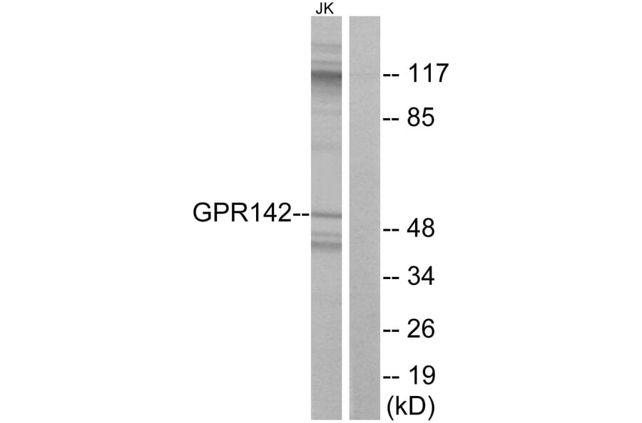 Western Blot - Anti-GPR142 Antibody (G296) - Antibodies.com