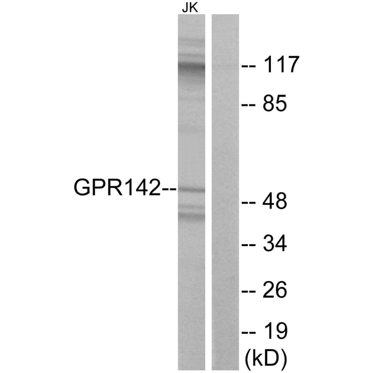 Western Blot - Anti-GPR142 Antibody (G296) - Antibodies.com