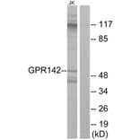 Western Blot - Anti-GPR142 Antibody (G296) - Antibodies.com