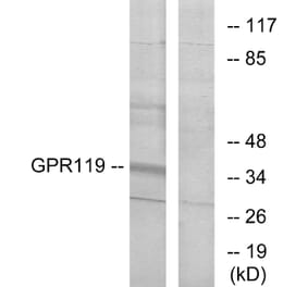 Western Blot - Anti-GPR119 Antibody (G125) - Antibodies.com
