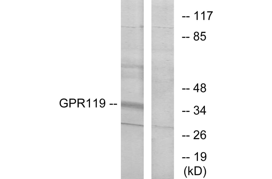 Western Blot - Anti-GPR119 Antibody (G125) - Antibodies.com