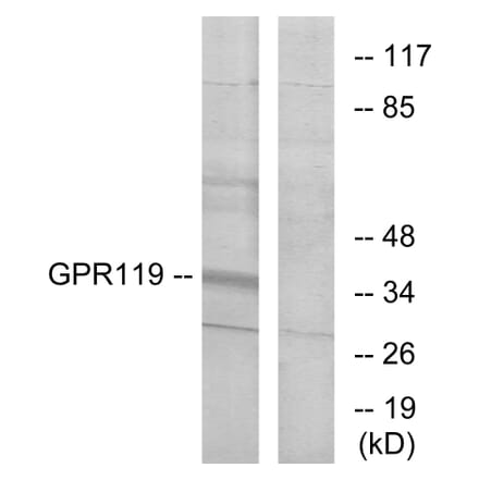 Western Blot - Anti-GPR119 Antibody (G125) - Antibodies.com