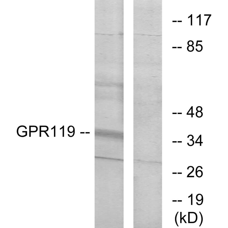 Western Blot - Anti-GPR119 Antibody (G125) - Antibodies.com