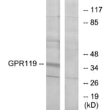 Western Blot - Anti-GPR119 Antibody (G125) - Antibodies.com