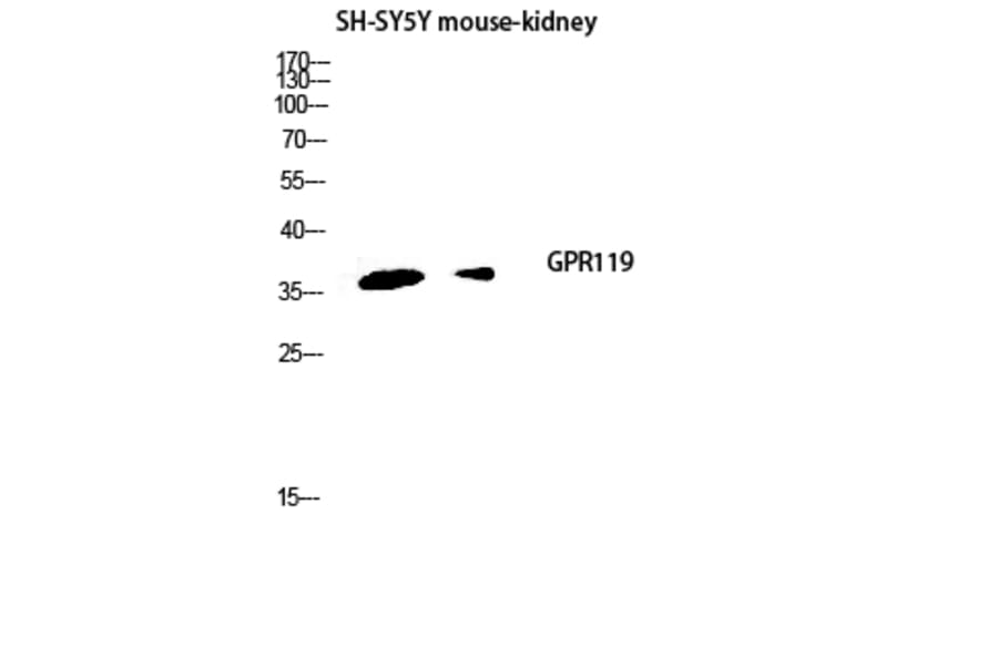 Western Blot - Anti-GPR119 Antibody (G125) - Antibodies.com