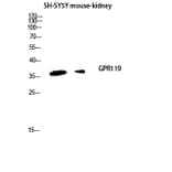 Western Blot - Anti-GPR119 Antibody (G125) - Antibodies.com