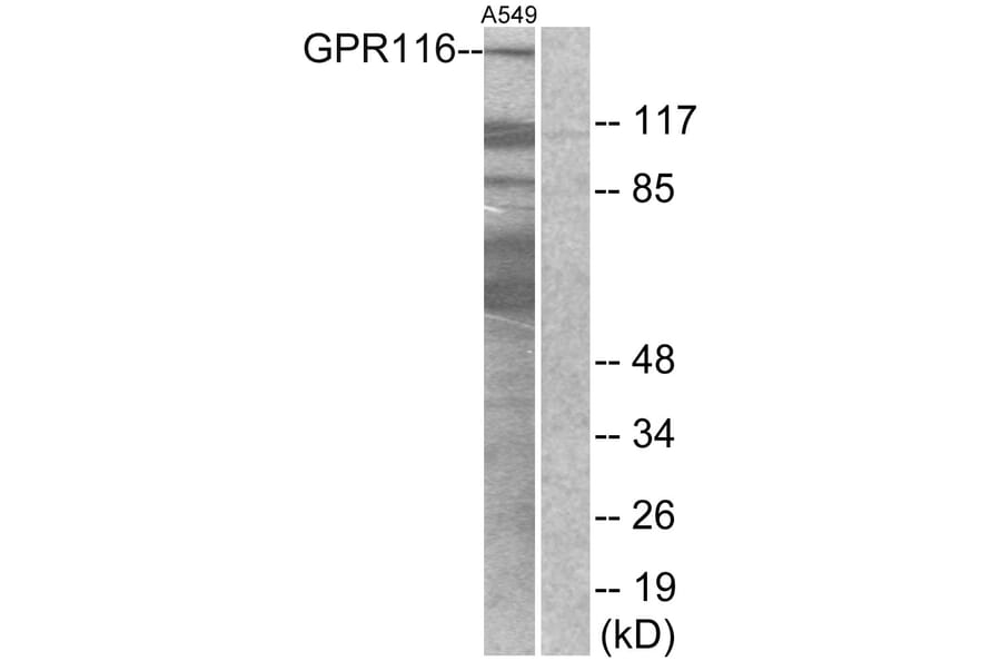 Western Blot - Anti-GPR116 Antibody (G286) - Antibodies.com