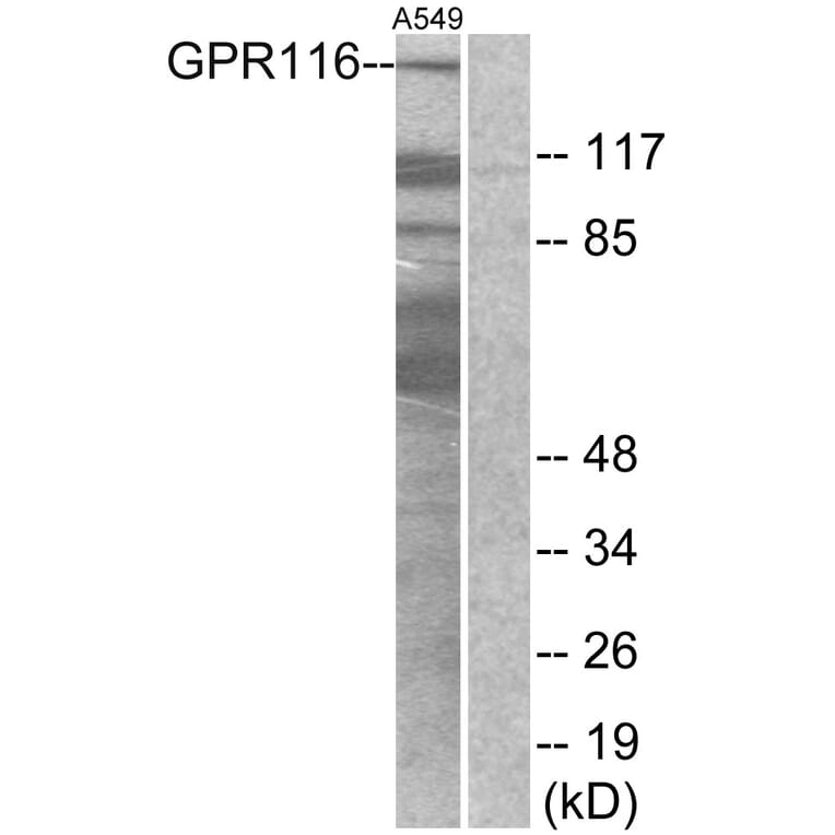 Western Blot - Anti-GPR116 Antibody (G286) - Antibodies.com