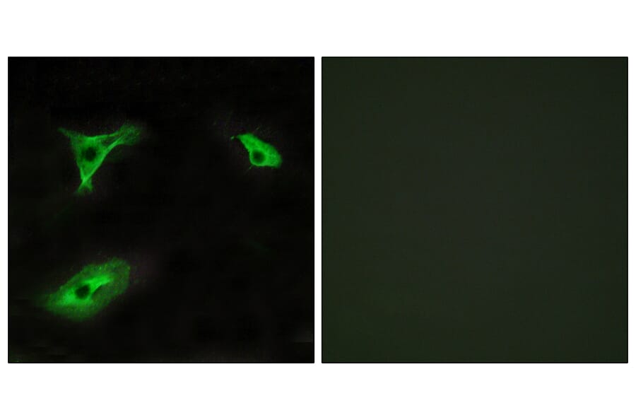 Immunofluorescence - Anti-GPR116 Antibody (G286) - Antibodies.com