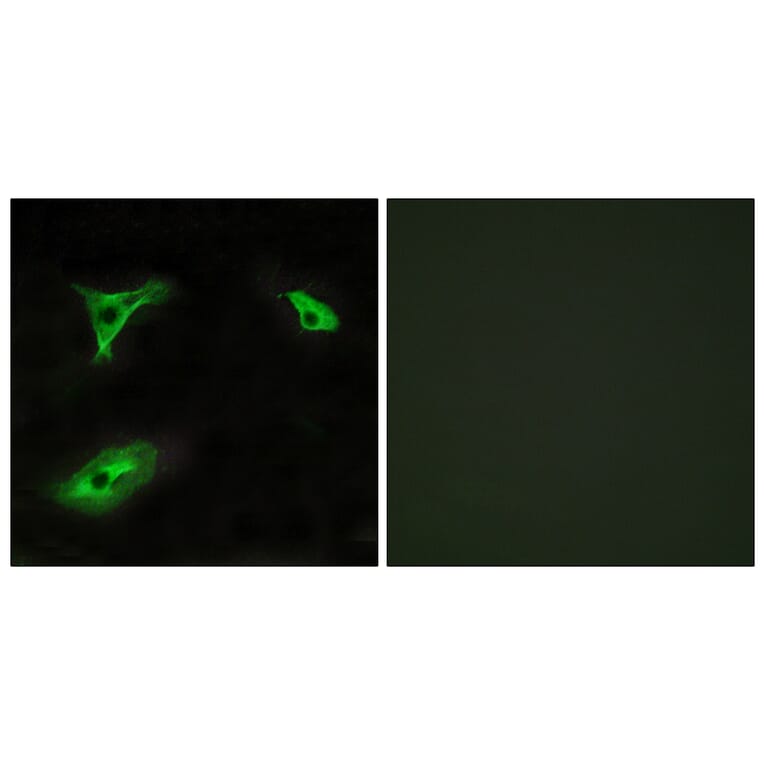 Immunofluorescence - Anti-GPR116 Antibody (G286) - Antibodies.com