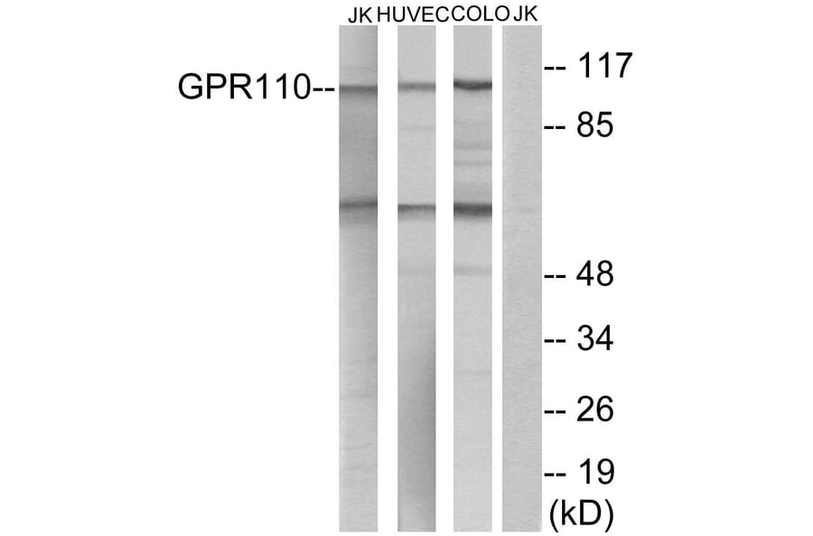 Western Blot - Anti-GPR110 Antibody (G122) - Antibodies.com