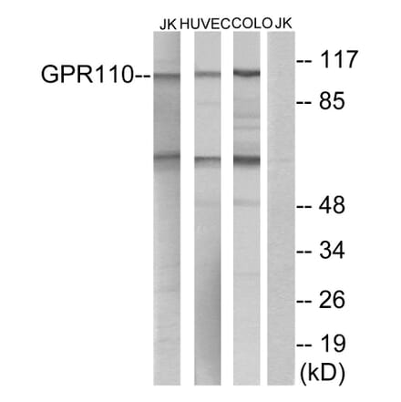 Western Blot - Anti-GPR110 Antibody (G122) - Antibodies.com