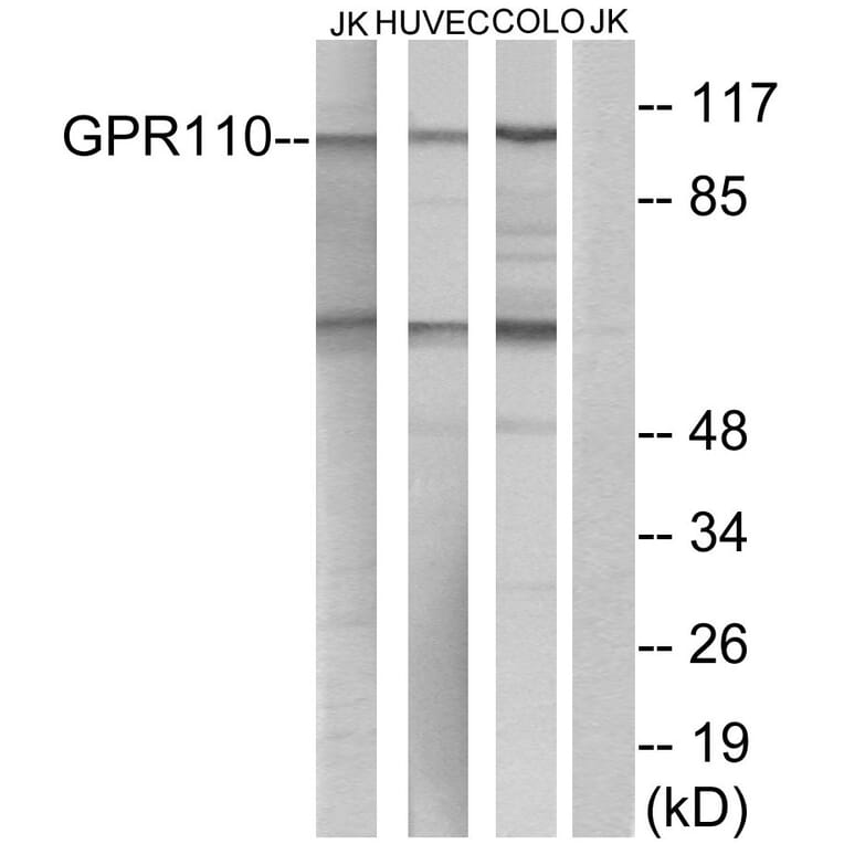 Western Blot - Anti-GPR110 Antibody (G122) - Antibodies.com