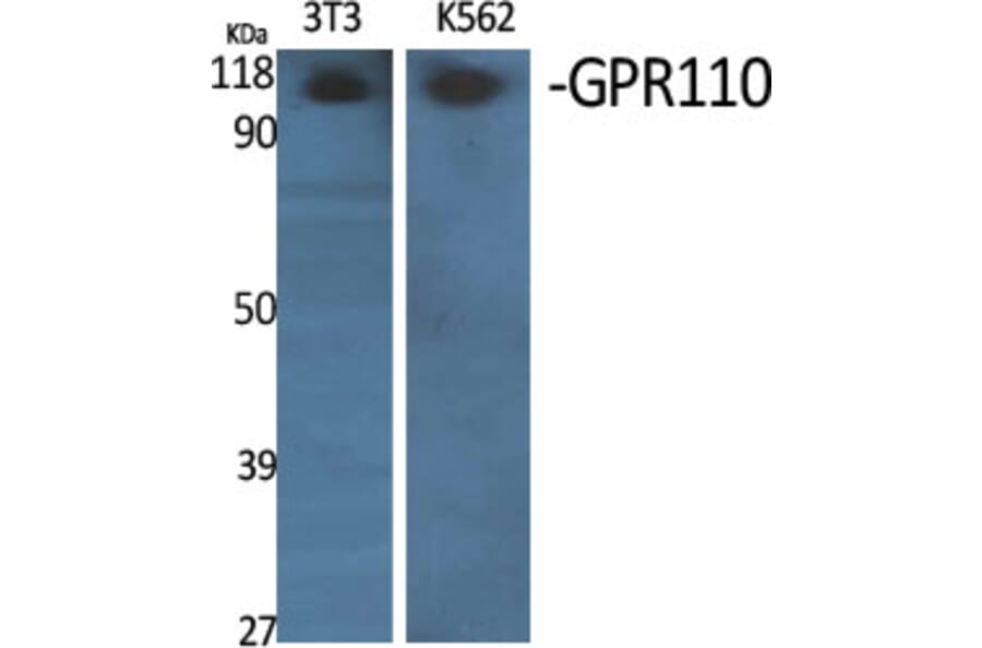 Western Blot - Anti-GPR110 Antibody (G122) - Antibodies.com