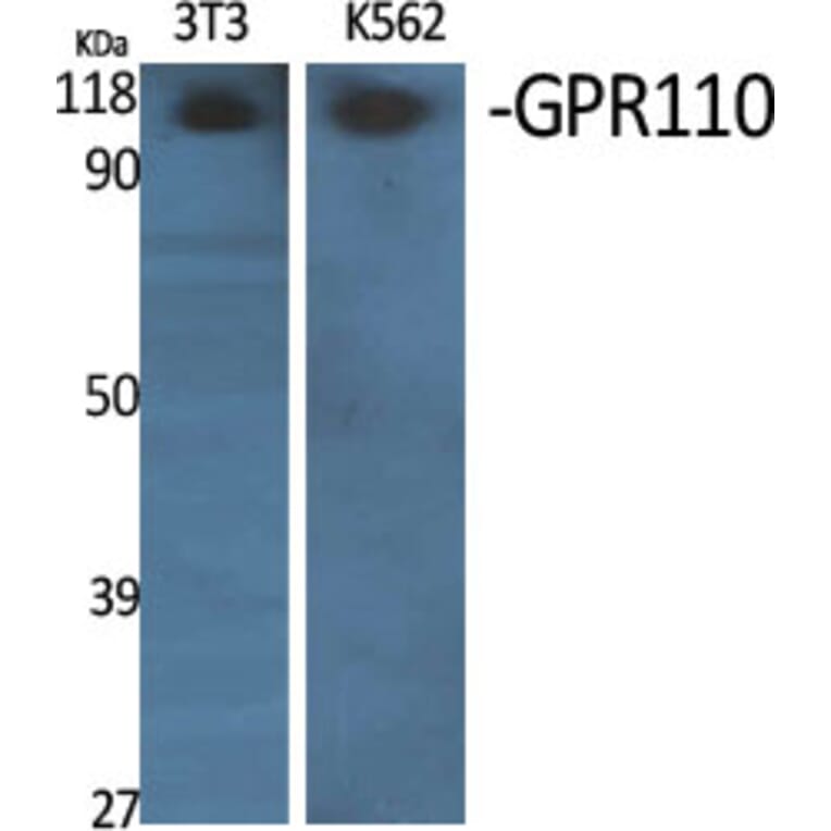 Western Blot - Anti-GPR110 Antibody (G122) - Antibodies.com