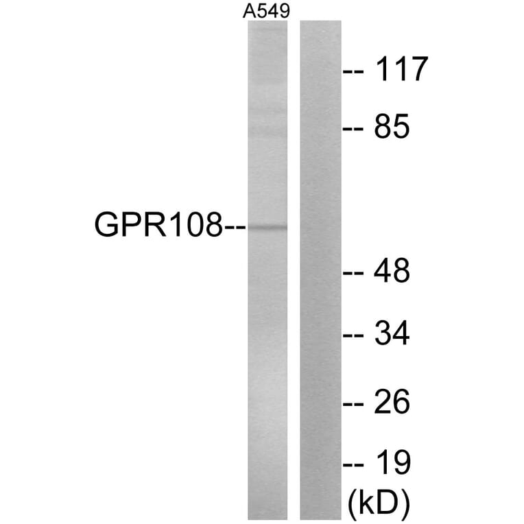 Western Blot - Anti-GPR108 Antibody (G280) - Antibodies.com