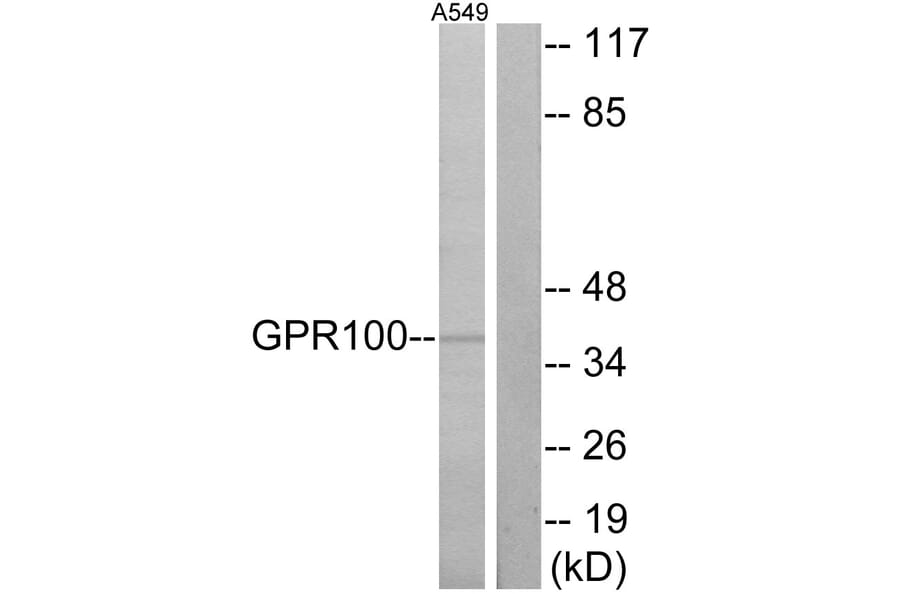 Western Blot - Anti-GPR100 Antibody (G117) - Antibodies.com