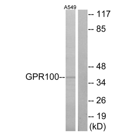 Western Blot - Anti-GPR100 Antibody (G117) - Antibodies.com