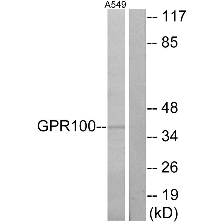 Western Blot - Anti-GPR100 Antibody (G117) - Antibodies.com