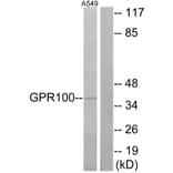 Western Blot - Anti-GPR100 Antibody (G117) - Antibodies.com