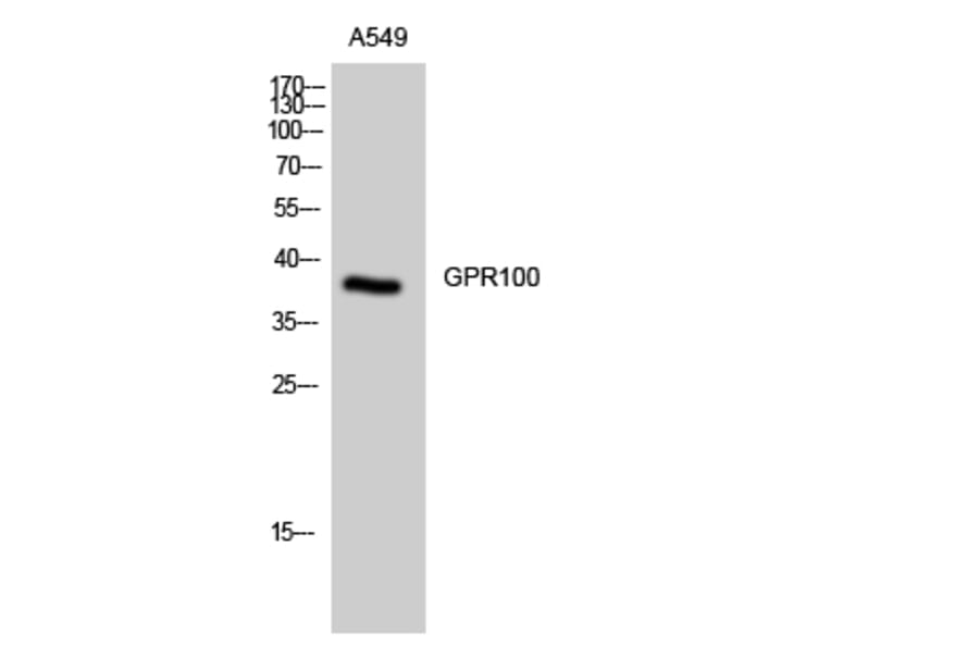 Western Blot - Anti-GPR100 Antibody (G117) - Antibodies.com
