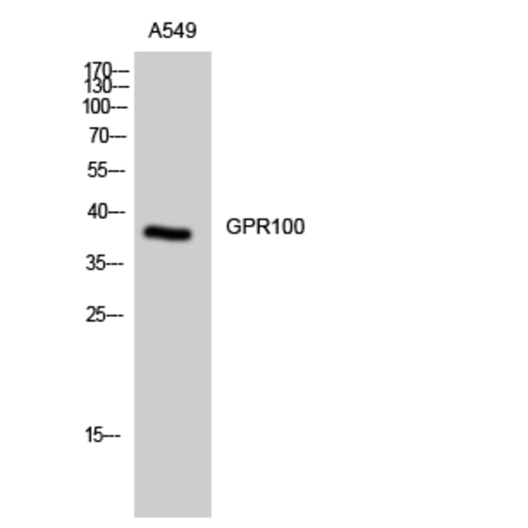 Western Blot - Anti-GPR100 Antibody (G117) - Antibodies.com