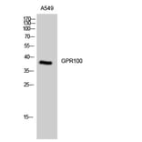 Western Blot - Anti-GPR100 Antibody (G117) - Antibodies.com