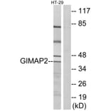 Western Blot - Anti-GIMAP2 Antibody (C16003) - Antibodies.com