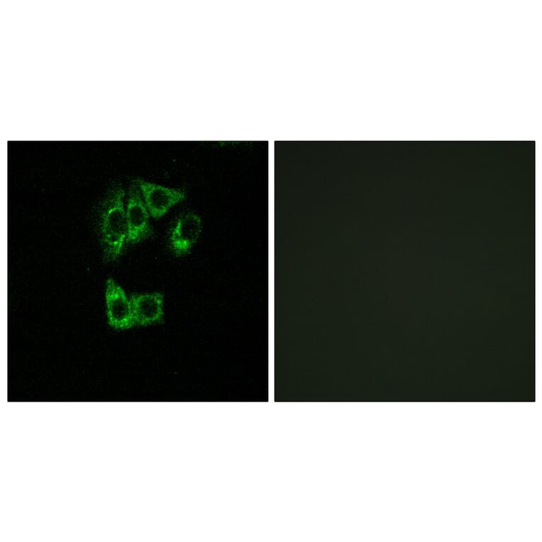 Immunofluorescence - Anti-GIMAP2 Antibody (C16003) - Antibodies.com