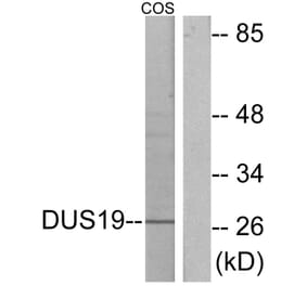Western Blot - Anti-DUSP19 Antibody (C11401) - Antibodies.com