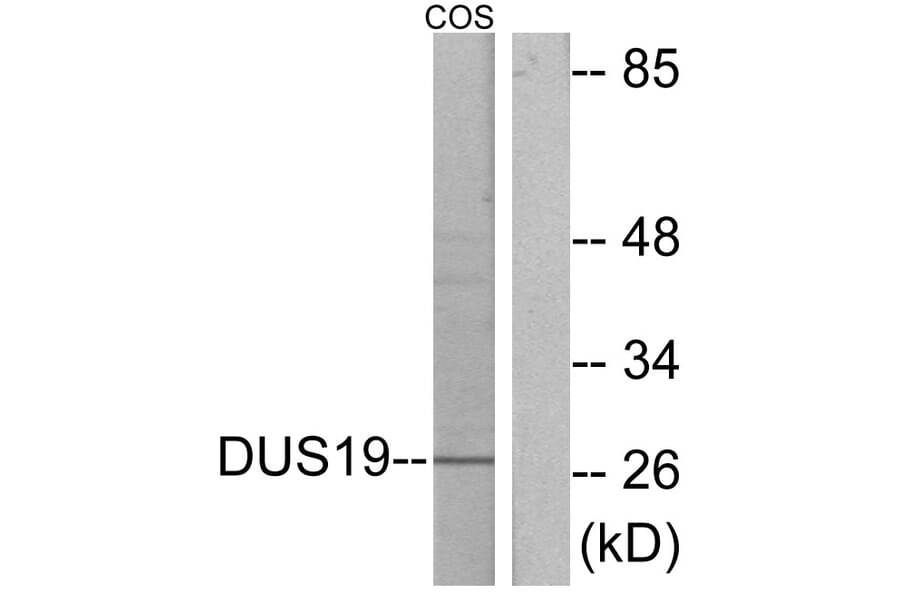 Western Blot - Anti-DUSP19 Antibody (C11401) - Antibodies.com