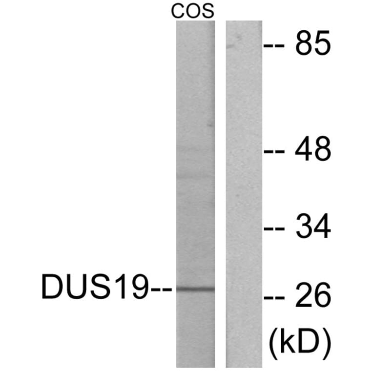 Western Blot - Anti-DUSP19 Antibody (C11401) - Antibodies.com