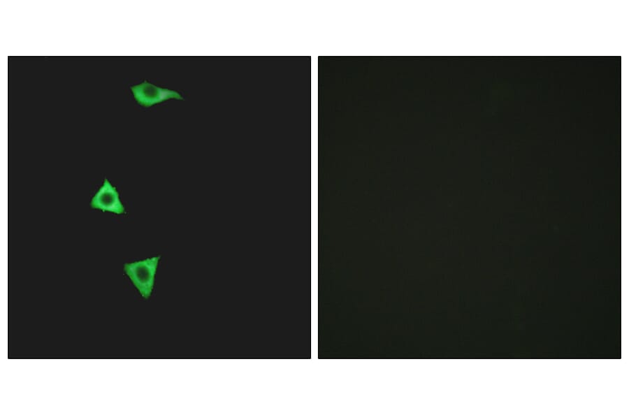 Immunofluorescence - Anti-BDKRB1 Antibody (G216) - Antibodies.com