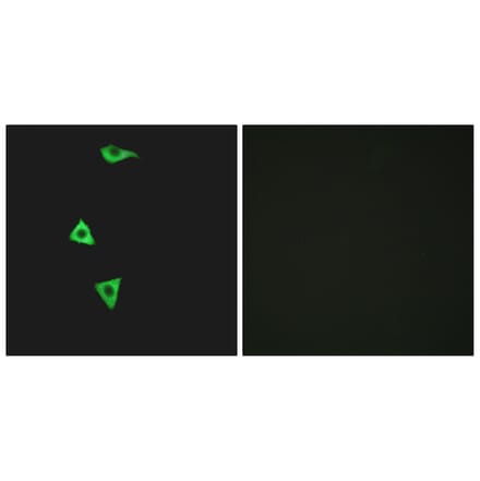 Immunofluorescence - Anti-BDKRB1 Antibody (G216) - Antibodies.com