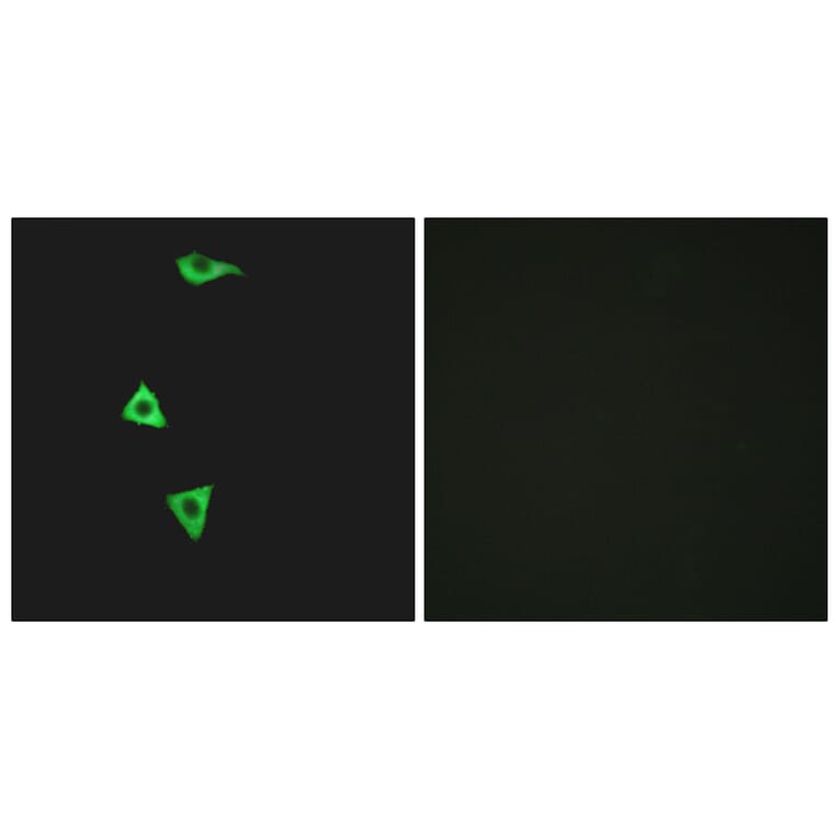 Immunofluorescence - Anti-BDKRB1 Antibody (G216) - Antibodies.com
