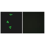 Immunofluorescence - Anti-BDKRB1 Antibody (G216) - Antibodies.com