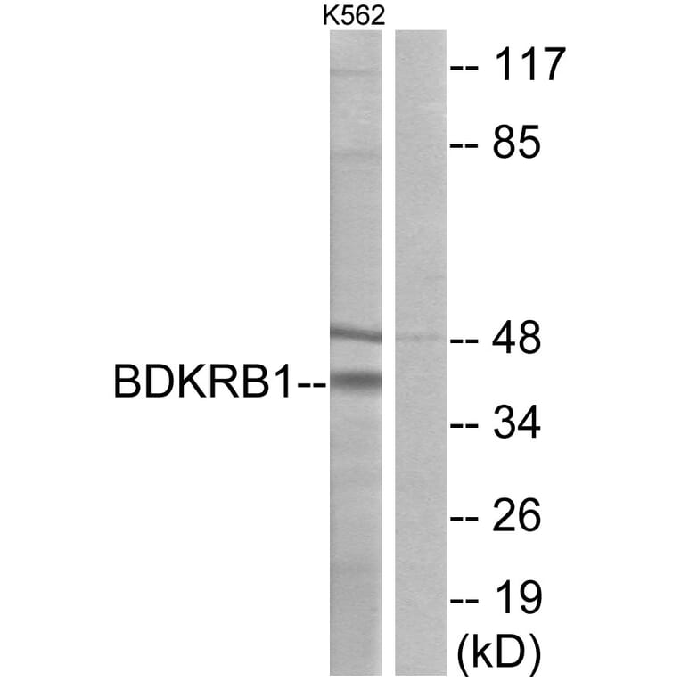 Western Blot - Anti-BDKRB1 Antibody (G216) - Antibodies.com