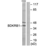 Western Blot - Anti-BDKRB1 Antibody (G216) - Antibodies.com