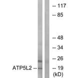 Western Blot - Anti-ATP5L2 Antibody (C14604) - Antibodies.com