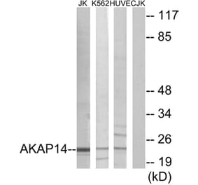 Western Blot - Anti-AKAP14 Antibody (C11279) - Antibodies.com