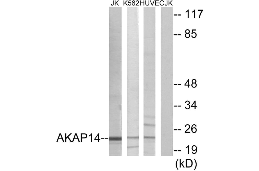Western Blot - Anti-AKAP14 Antibody (C11279) - Antibodies.com