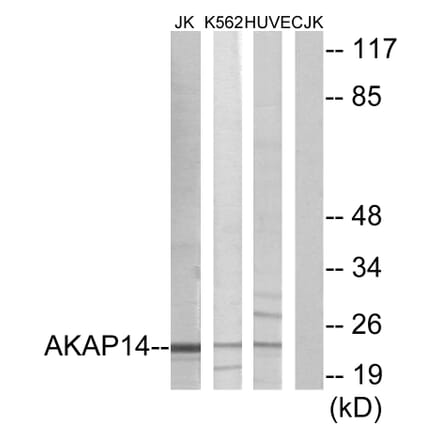 Western Blot - Anti-AKAP14 Antibody (C11279) - Antibodies.com