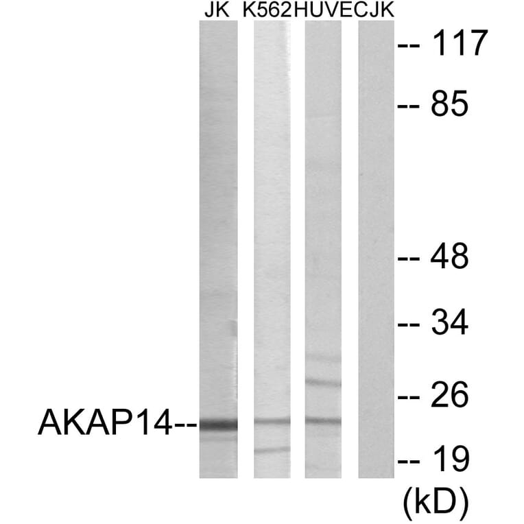 Western Blot - Anti-AKAP14 Antibody (C11279) - Antibodies.com