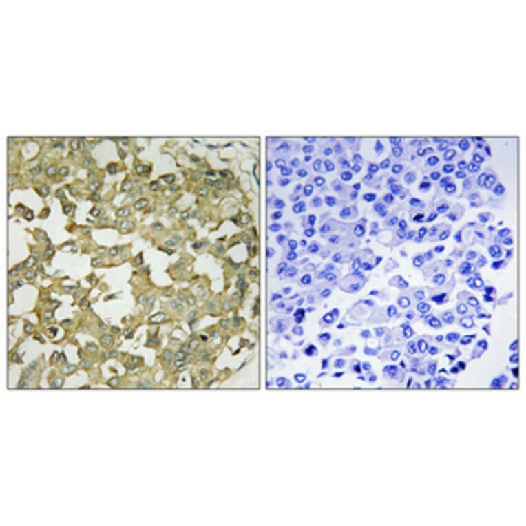 Immunohistochemistry - Anti-AGTRL1 Antibody (G031) - Antibodies.com