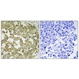 Immunohistochemistry - Anti-AGTRL1 Antibody (G031) - Antibodies.com