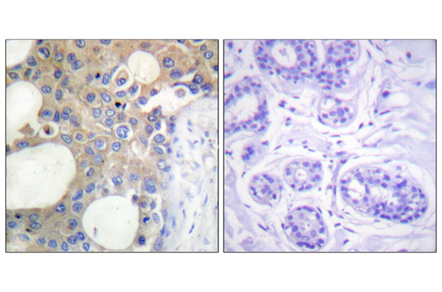 Immunohistochemistry - Anti-CD227 Antibody (B1193) - Antibodies.com